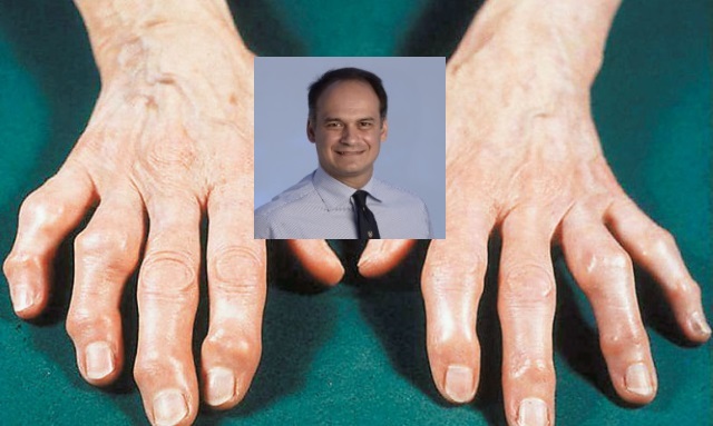 arthritida tsir1